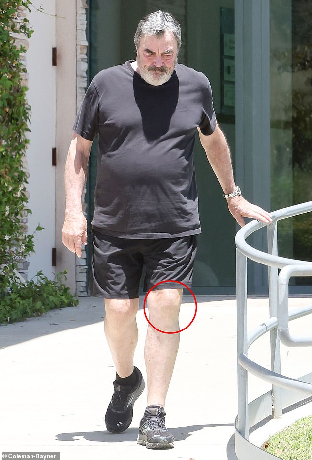 With age, Selleck has noticeably slowed down due to his weight gain and reports of a persisting limp. In July 2024, rumors swirled when he was spotted with what appeared to be surgery scars on his knees