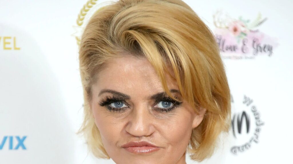 Danniella Westbrook in hospital for life changing op to rebuild her face after years of cocaine abuse