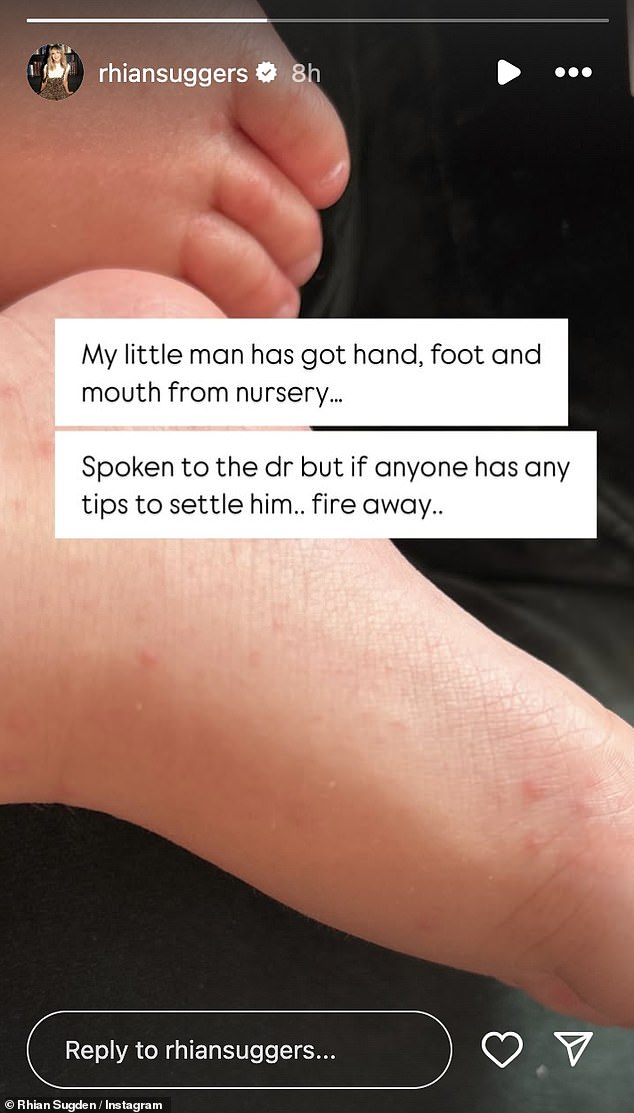 The model, 38, shared an update to her Instagram Story and asked her followers for some tips