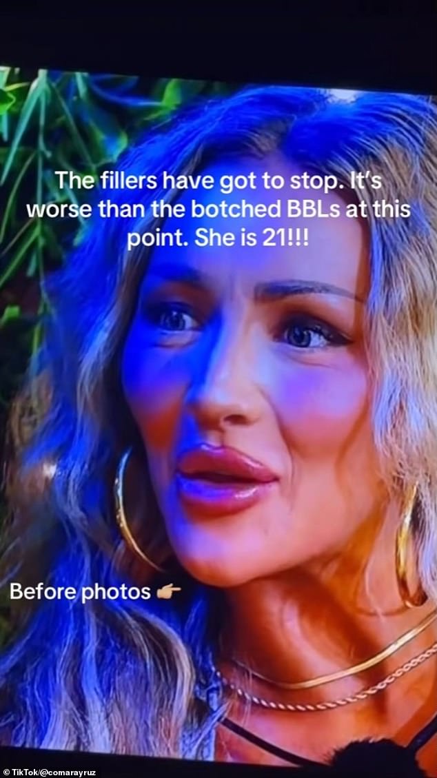 When she got her phone back, her mom told her to wait and go online when she was with her - but she didn't listen and saw all the comments from people eviscerating her looks