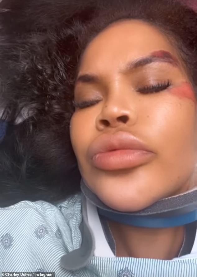 The reality TV star, 40, took to her Instagram Stories on Wednesday to detail the shocking incident, telling fans she had been hit by a truck