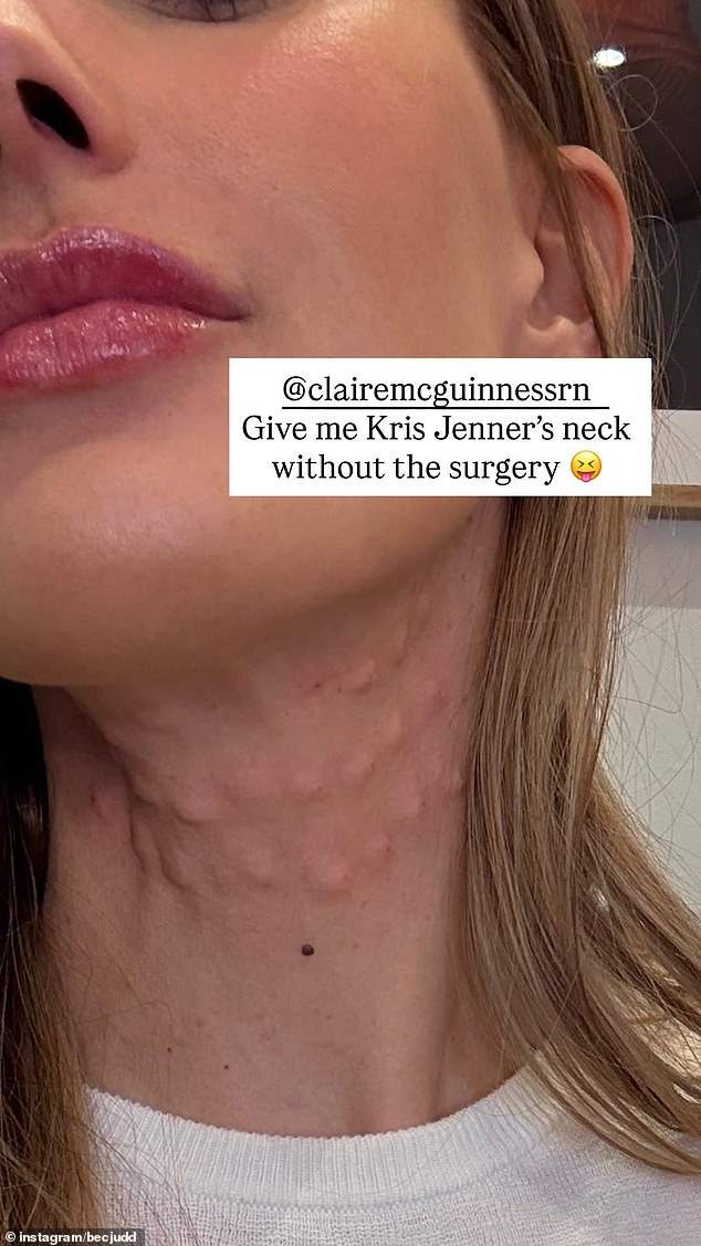 'Give me Kris Jenner's neck without the surgery,' Bec captioned a snapshot