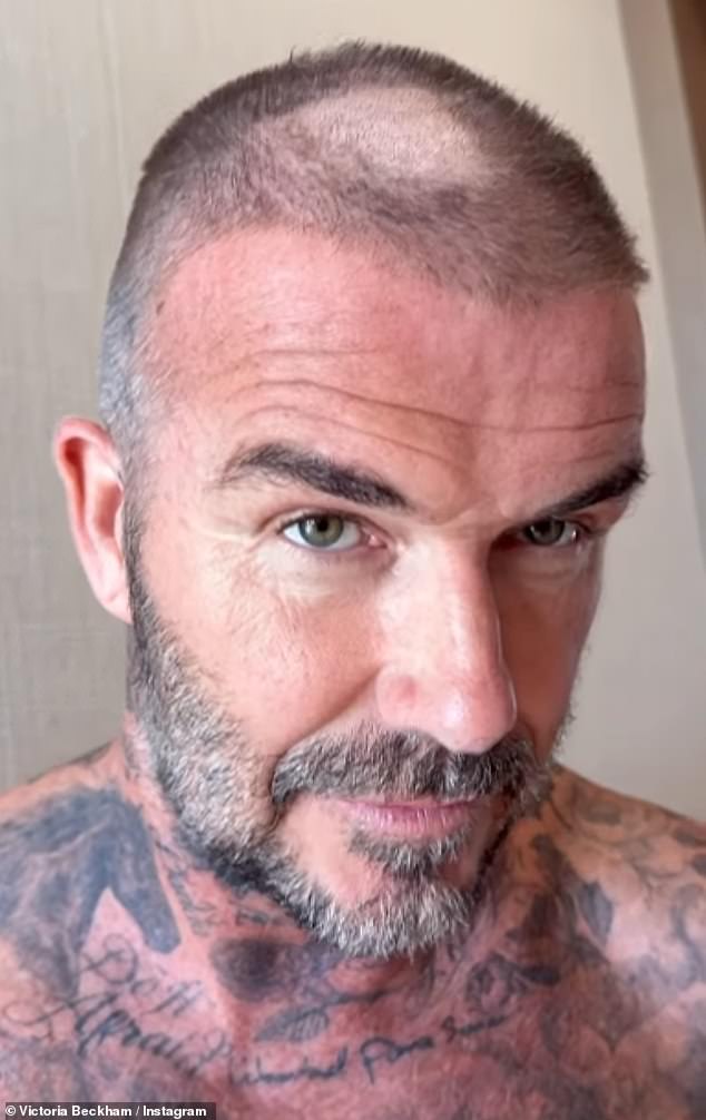 But the former footballer came a cropper after the head fell from his clippers mid-shave - leaving him with a glaring bald patch on the top of his head