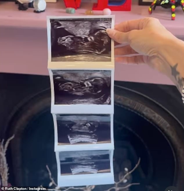 The influencer also shared photos from her first ultrasound scan with Instagram followers
