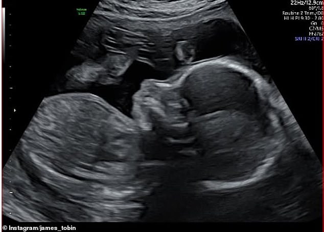 The notoriously private couple shared the happy announcement on Sunday, posting a sweet selfie alongside a sonogram image to Instagram