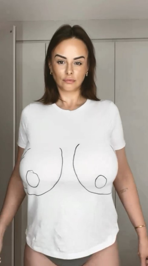 Woman wearing a white t-shirt with a drawing of breasts; before and after breast reduction.
