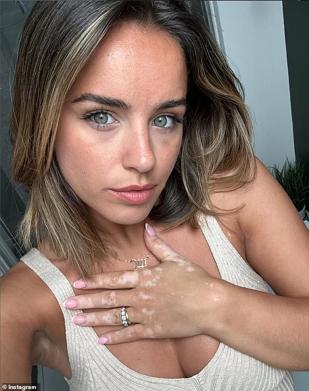 The beauty revealed how the work has dried up since returning to the UK from Serbia where she'd filmed The Outpost, detailing how this has been the 'quietest time' in her life