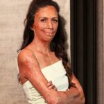 Burns survivor Turia Pitt (pictured) has revealed her new book