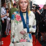 Liam Gallagher 's ex-wife Patsy Kensit revealed she's suffered a shocking accident , in a post shared just hours ahead of Oasis' huge reunion gig on Friday (pictured on Thursday evening)