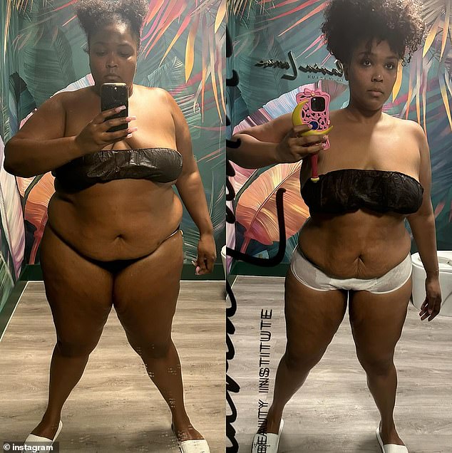 Lizzo took to Instagram on Thursday to display her extraordinary weight loss in stripped down side-by-side photos