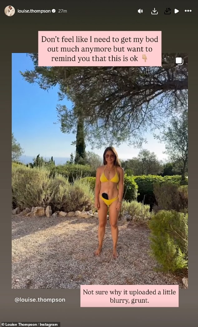 Taking to Instagram on Sunday, Louise admitted in a candid post that she us wearing less bikinis and switching to swimsuits, in part because she notices people looking at her stoma