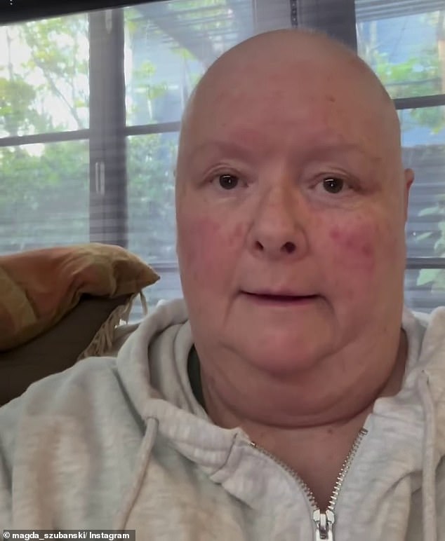 The beloved Kath and Kim star took to social media on Monday night with a new clip revealing her shaved head - a result of chemotherapy as she battles Mantle Cell Lymphoma